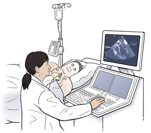 Man lying on side on exam table with EKG leads on chest. Technician is holding ultrasound probe to man's chest. 