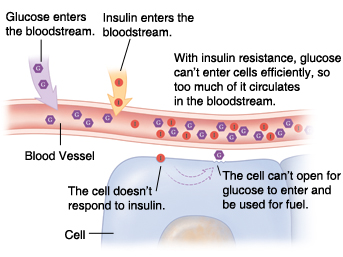 Cross section of blood vessel and cell showing glucose building up in bloodstream because of insulin resistance.