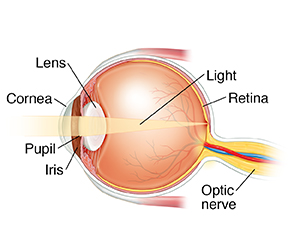 Side view cross section of eye showing light focusing on retina.