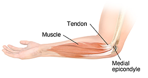 Side view of forearm with hand palm-side up, showing muscles and bones.